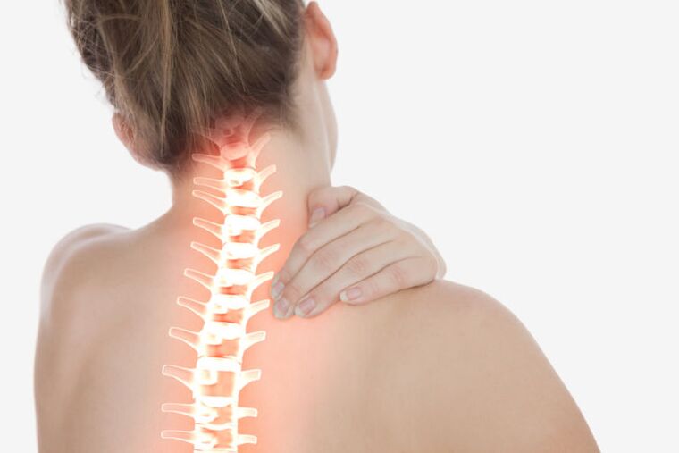 osteocondrose da coluna cervical